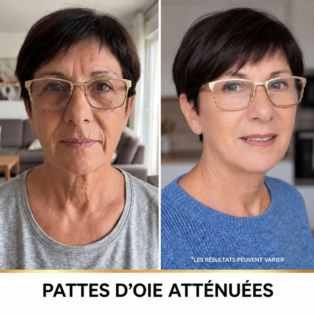 Miol Skin® - Box Complète : Sérum Peptides de Soie + Fond de Teint Auto-Adaptatif SPF 15