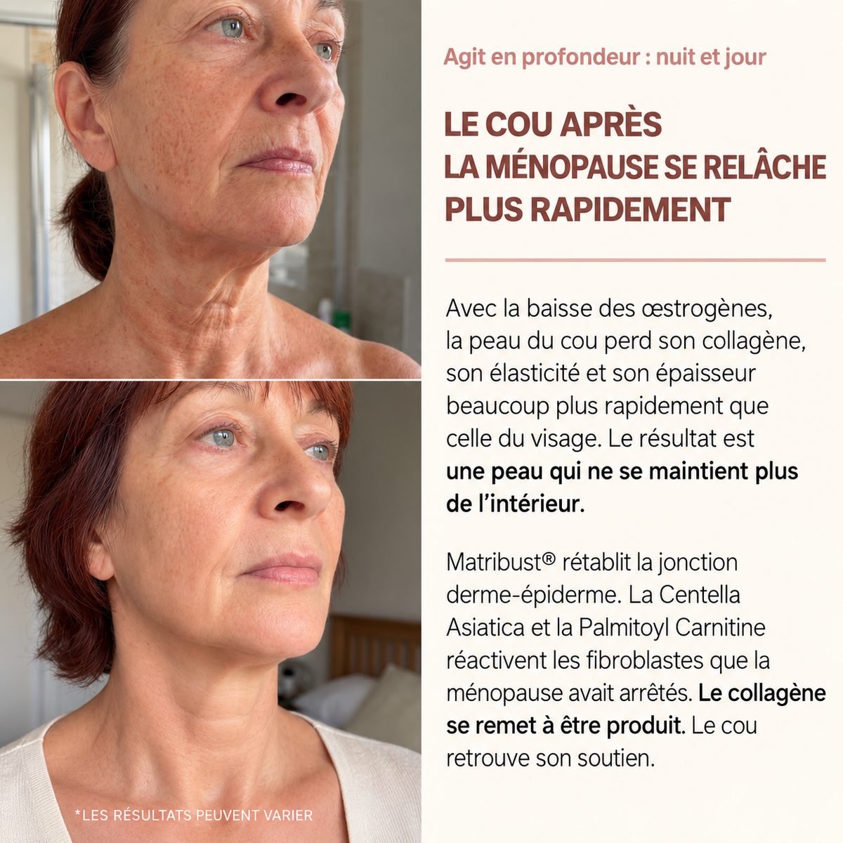 Miol Skin® - Crème Cou Liftante & Raffermissante