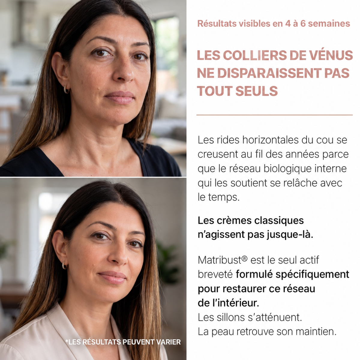 Miol Skin® - Crème Cou Liftante & Raffermissante
