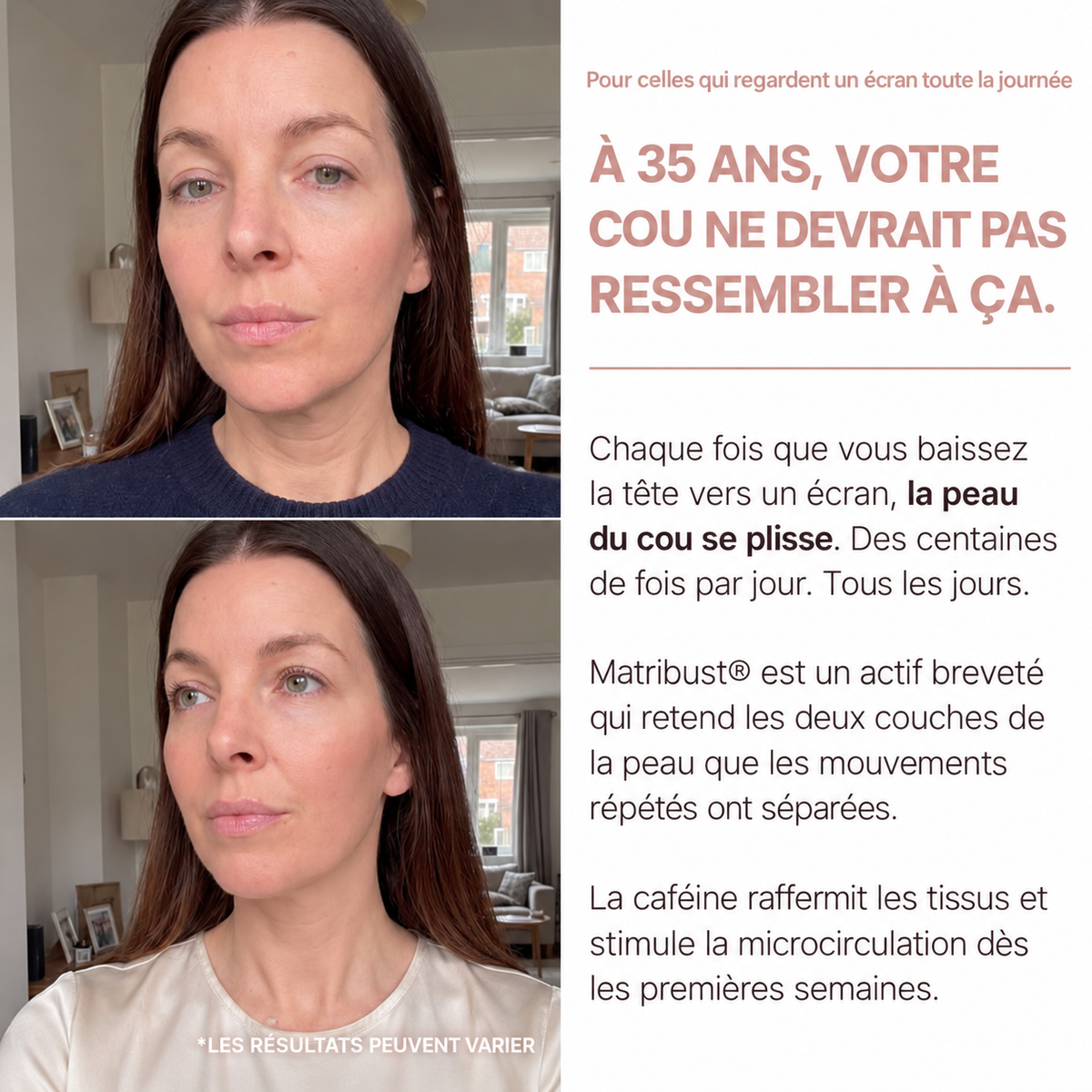 Miol Skin® - Crème Cou Liftante & Raffermissante